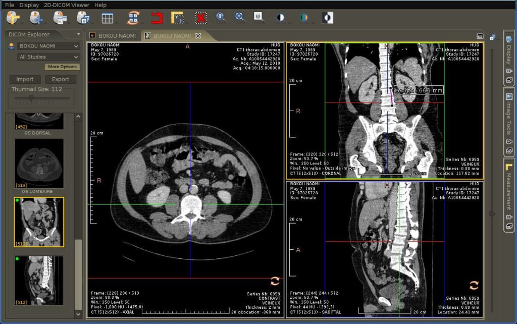 DICOM viewer free download