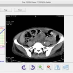 DICOM viewer free download