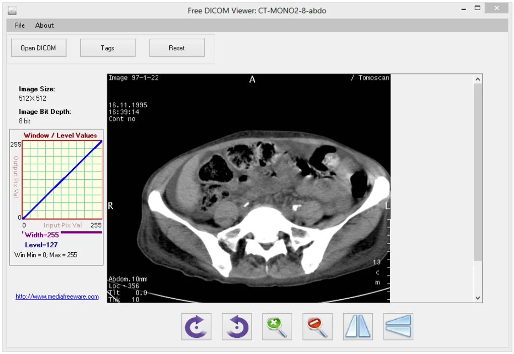 DICOM viewer free download