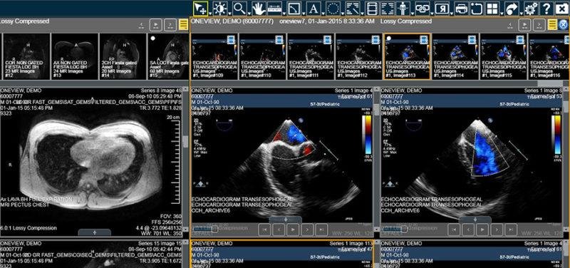 medical imaging data