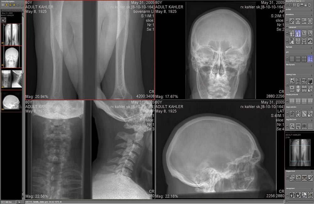PACS medical imaging software