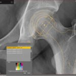 PACS medical imaging software