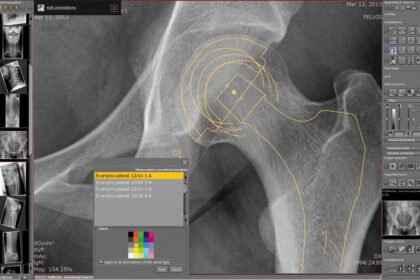 PACS medical imaging software