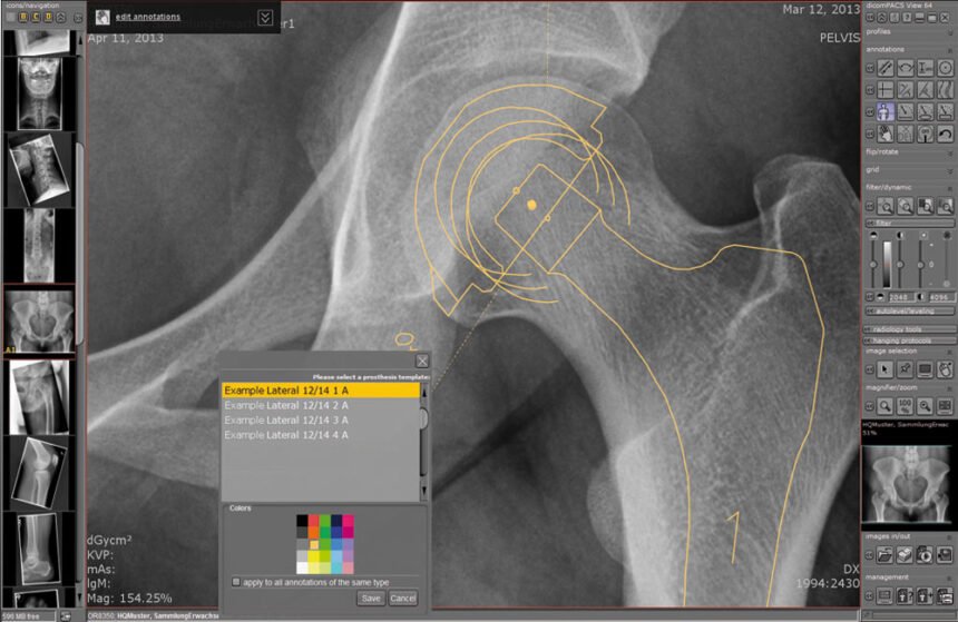 PACS medical imaging software